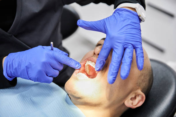 Best Emergency Root Canal Treatment in Mercerville, NJ